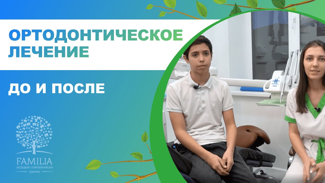 ?_♂️ Ортодонтическое лечение до и после. Отзыв пациента