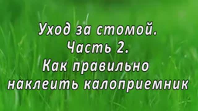 Уход за стомой часть 2. Как правильно наклеить калоприемник?