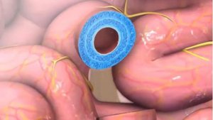 Желудочно кишечный тракт