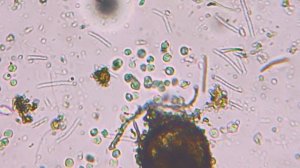 Бактерии в "Царстве Мха"