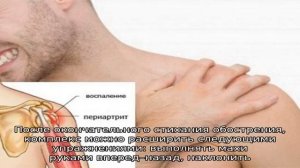 Лечебная гимнастика при плечелопаточном периартрите