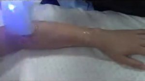 диодный лазер 808 нм для эпиляции Anchorfree 808-M