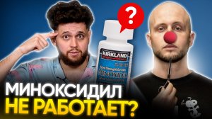 ОТВЕТ КАНАЛУ BARBAROSSA: Миноксидил действительно не работает?