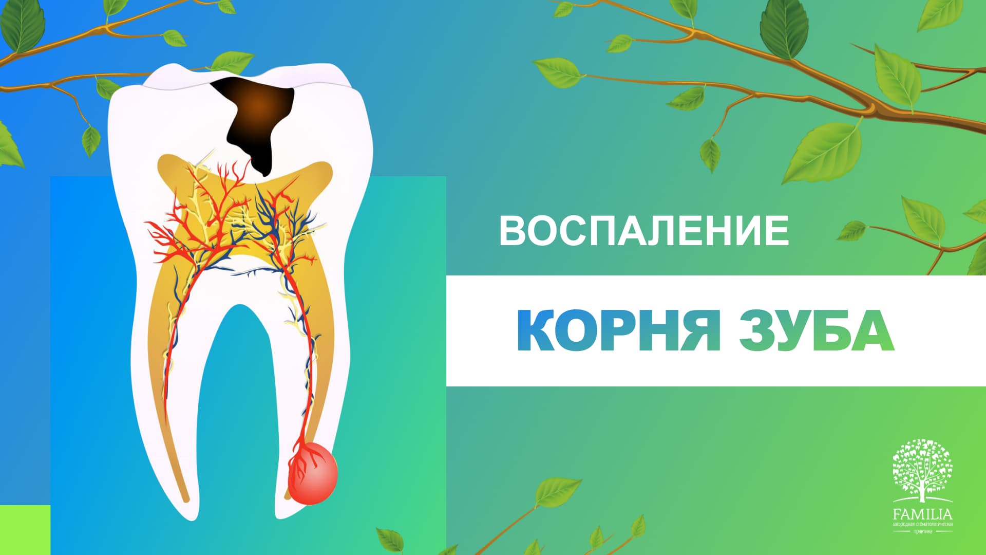 Антибиотик в стоматологии при воспалении корня зуба. Воспаление корня зуба под коронкой.