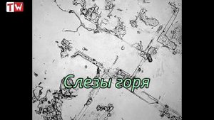 Как выглядят слезы (под микроскопом)?