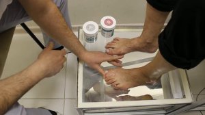 Изготовление индивидуального межпальцевого корректора