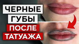 ТАК делать перманент губ ЗАПРЕЩЕНО! / Чёрные губы после татуажа – ЧТО ДЕЛАТЬ?
