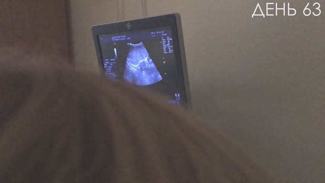 Как ребенку сделать УЗИ. смотреть онлайн