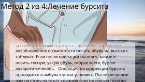 Как выпрямить пальцы ног