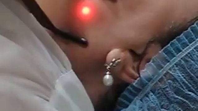 Медичний кабінет "Брасс. Здорова Шкіра". Процедура Т3 -омолодження смотреть онлайн