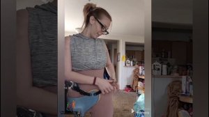 The beautiful woman has an amputated leg due to cancer and lives with an artificial leg