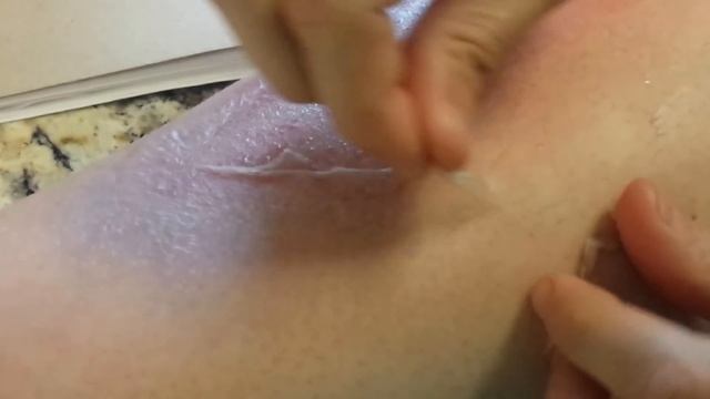 The sound of peeling a sunburn смотреть онлайн