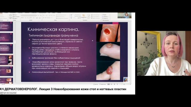 Обучение ОНЛАЙН специалиста по педикюру, подолога! Уникальный проект с командой врачей! смотреть онлайн