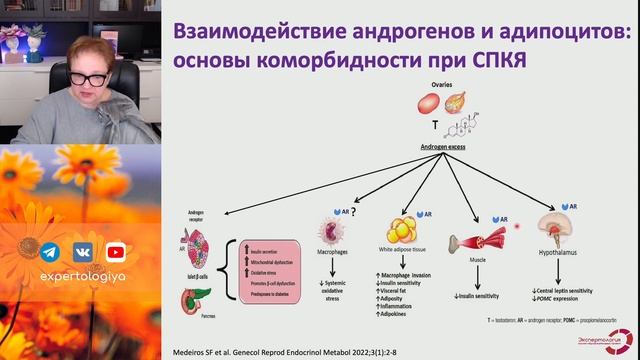 СПКЯ одно или два заболевания? l Пустотина О. А. смотреть онлайн