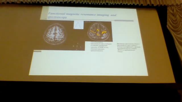 С. Д. Варфоломеев. Молекулярные основы интеллекта. Кинетика химических реакций в мозге человека. смотреть онлайн