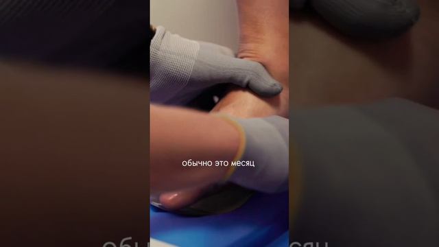 Зачем нужна коррекция стелек #ортопед #ортопедическиестельки #стельки