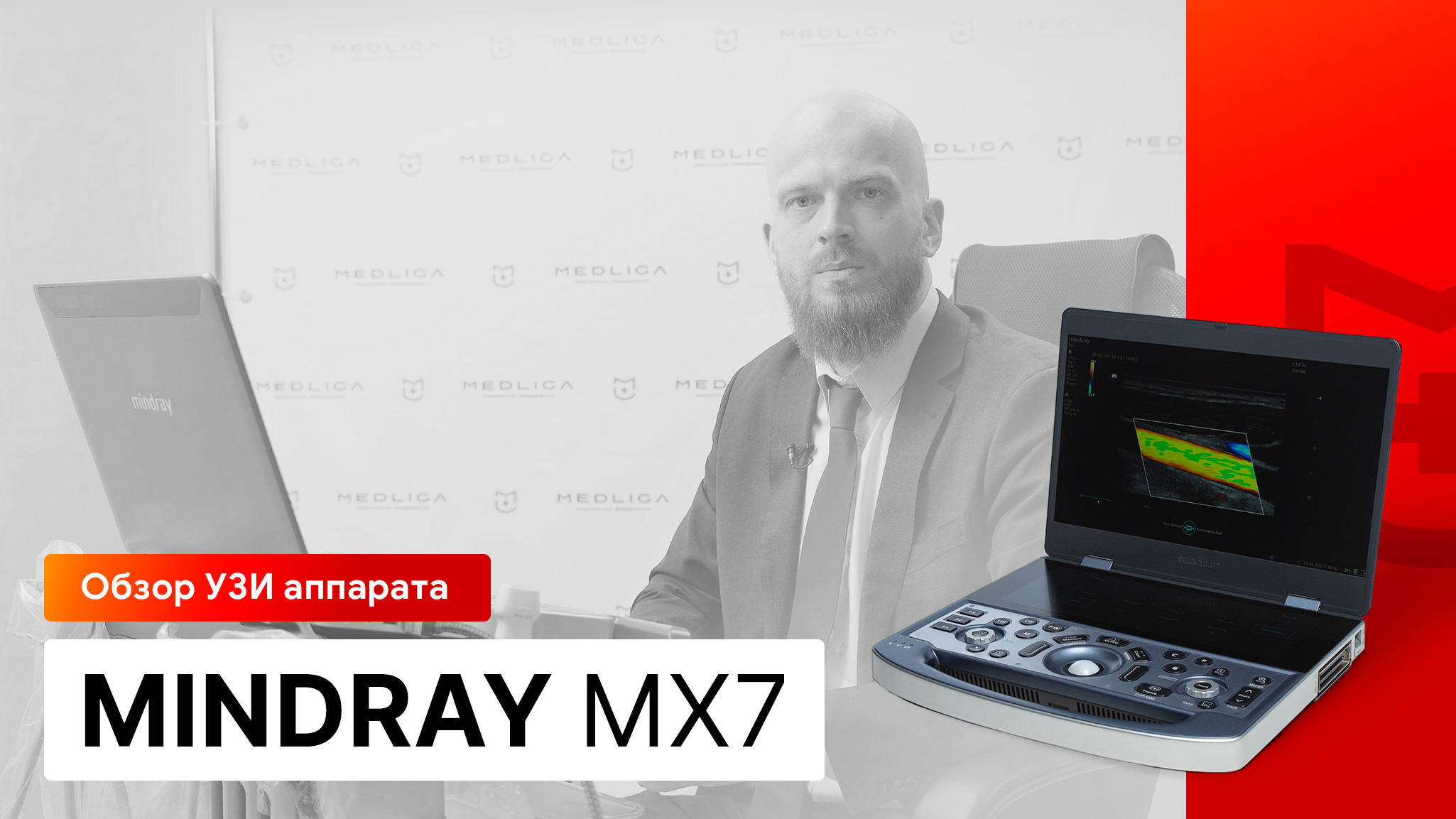 Обзор УЗИ аппарата Mindray MX7. Первый ультразвуковой аппарат на платформе ZST+