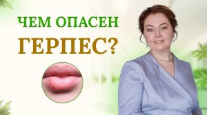 Чем опасен герпес?Чем закончится герпес, если не лечить? Отвечает врач-иммунолог,кмн Ольга Брум
