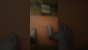 Перелом пятки
