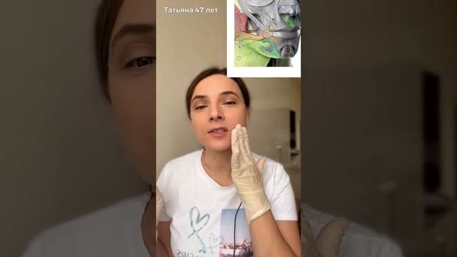 Буккальный массаж