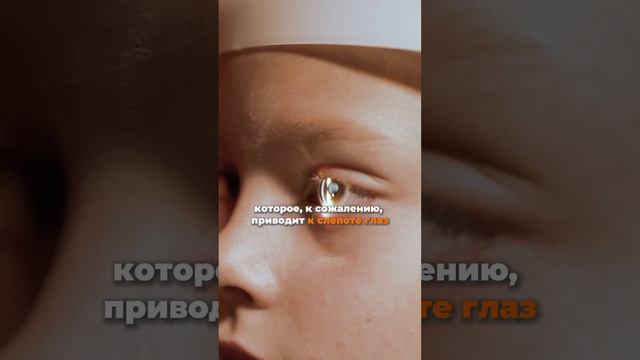 О чем говорит СВЕТОБОЯЗНЬ у ребенка и что делать #светобоязнь #здоровьеребенка #окулист #офтальмолог