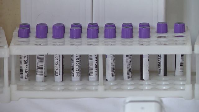 Более 150-ти работников ОЭМК приняли участие в донорской акции. смотреть онлайн