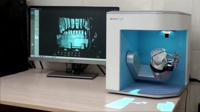 Сканирование зубов. Зуботехническая лаборатория