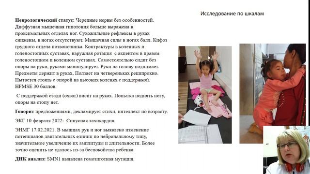 Экзореабилитация детей с проксимальной спинальной мышечной атрофией в Кыргызстане смотреть онлайн