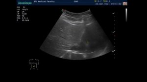 Отработка аккредитационных сценариев по трансабдоминальному ультразвуковому исследованию