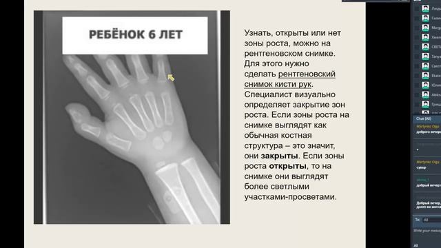 Как увеличить рост взрослого, ребенка и подростка смотреть онлайн