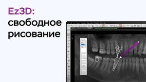 Возможности программы Ez3D: свободное рисование