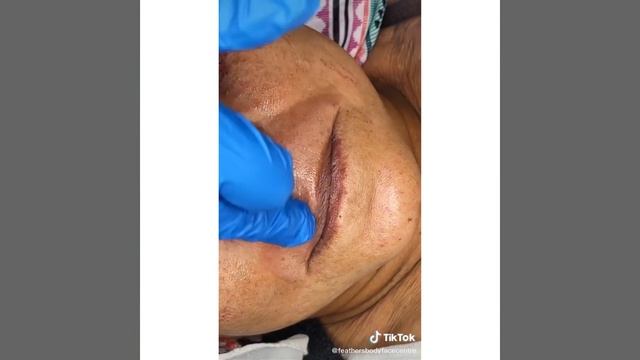 Most Extreme Beauty Treatments 2022 Best Smart and Helpful Beauty Hacks | Virtual Beauty