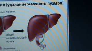 ОБЩИЙ ПРОТОК и СФИНКТЕР ОДДИ.часть№4