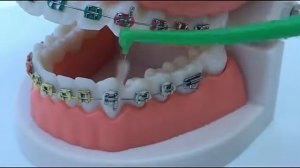 Межзубные ершики для брекетов