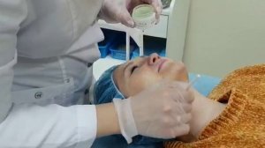 Желтый пилинг