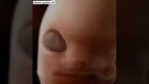 Этапы развития плода в утробе матери описанные в Коране.