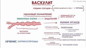 Васкулит