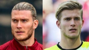 Loris Karius Hairline Too Low!? My Thoughts PART 2