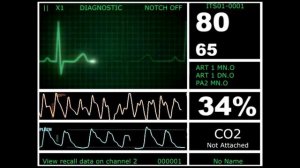 Hospital Monitor with FlatLine (M) (HD)