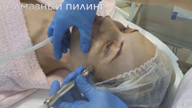 Алмазный Пилинг Центр косметологии Эстетика Сочи смотреть онлайн