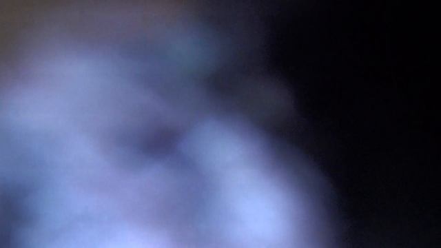 свищи у Лёли смотреть онлайн