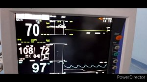 How to operate  life scope nihon kohden paitient monitor