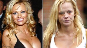 Знаменитости, Которые Сильно Себя Запустили