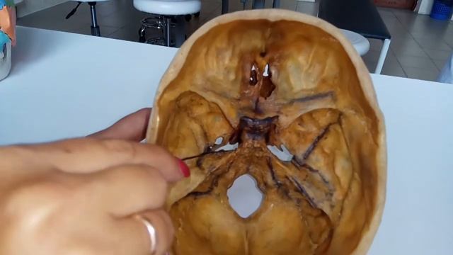 ПЕРЕДНЯЯ,  СРЕДНЯЯ, ЗАДНЯЯ ЧЕРЕПНЫЕ  ЯМКИ ВНУТРЕННЕГО ОСНОВАНИЯ ЧЕРЕПА