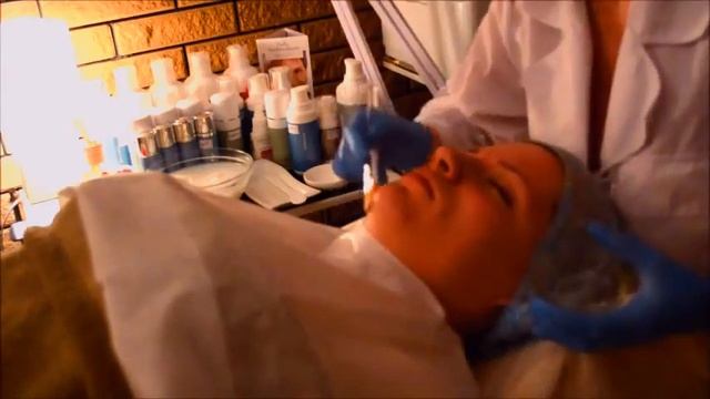 Процедура пилинга смотреть онлайн