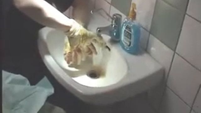 Десмургия - отмачивание старых повязок.avi