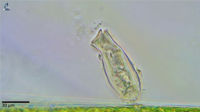 Инфузория Пиксикола. Ciliate Pyxicola. смотреть онлайн