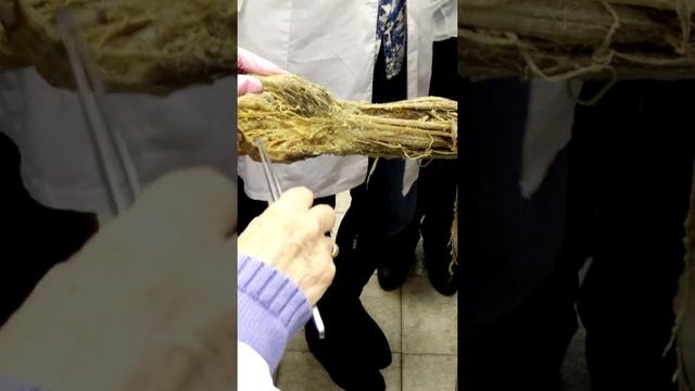 Мышцы верхних конечностей. Предплечье. Передняя группа мышц.