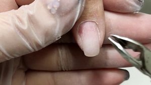 Травма ногтя ?Тонкая ,налипшая кутикула /Преображение ручек.