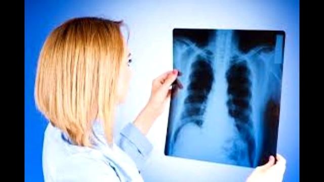 Первые симптомы туберкулеза. / ВСЕ ОБО ВСЕМ смотреть онлайн